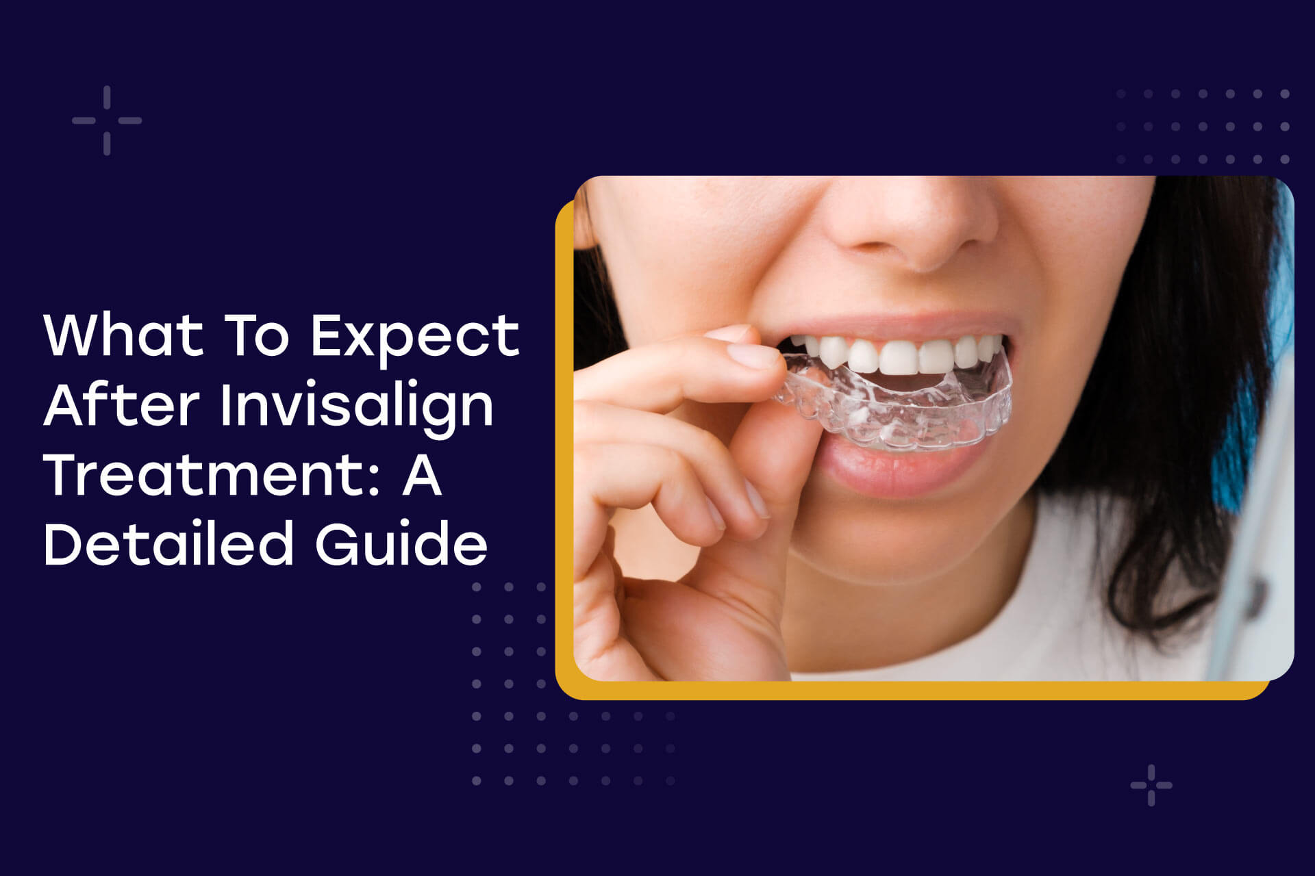 Blog What To Expect After Invisalign Treatment A Detailed Guide