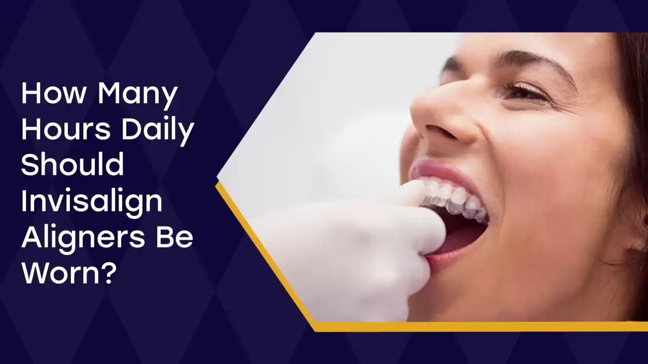 Invisalign Aligners Be Worn