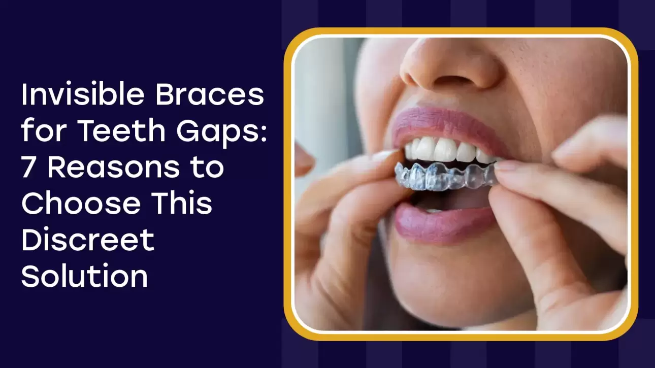 Invisible Braces For Teeth Gaps 7 Reasons To Choose This Discreet Solution