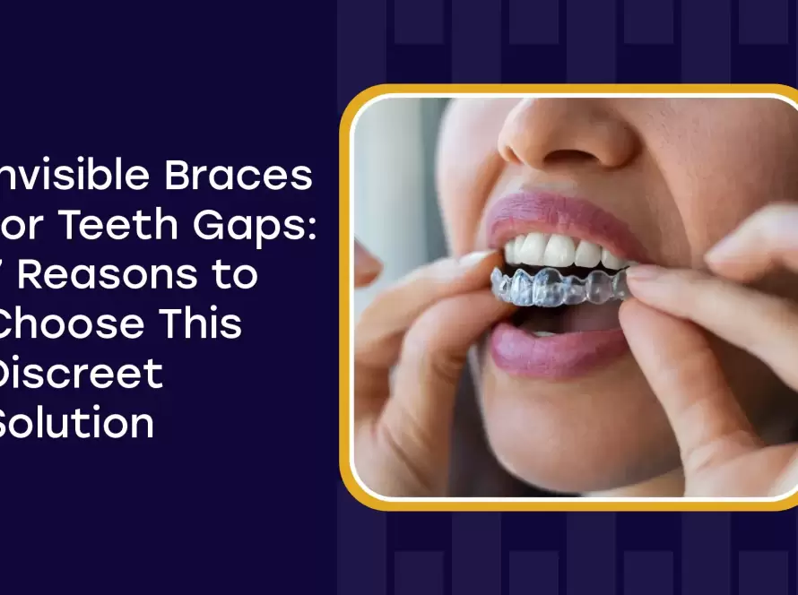 Invisible Braces For Teeth Gaps 7 Reasons To Choose This Discreet Solution