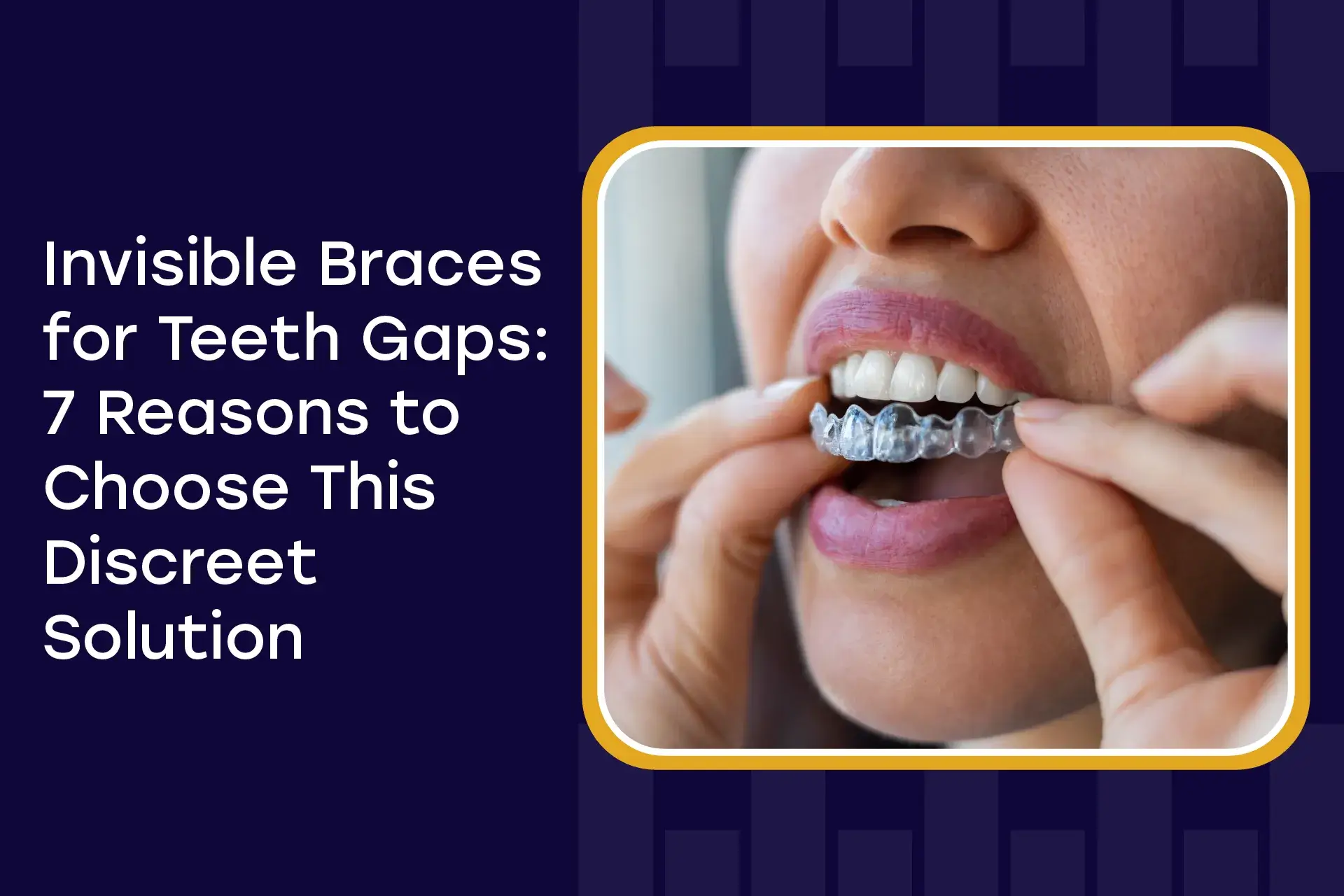 Invisible Braces For Teeth Gaps 7 Reasons To Choose This Discreet Solution