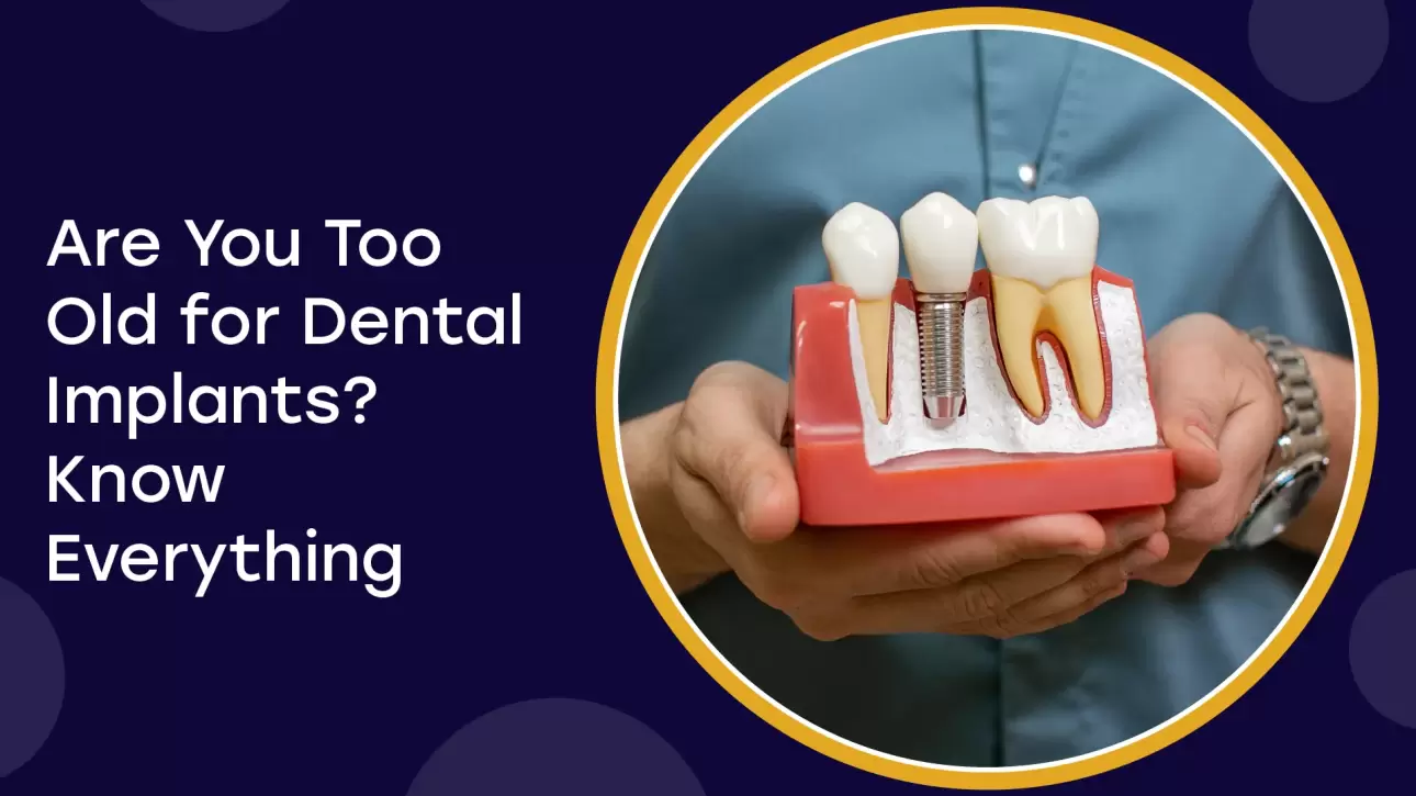 Old For Dental Implants