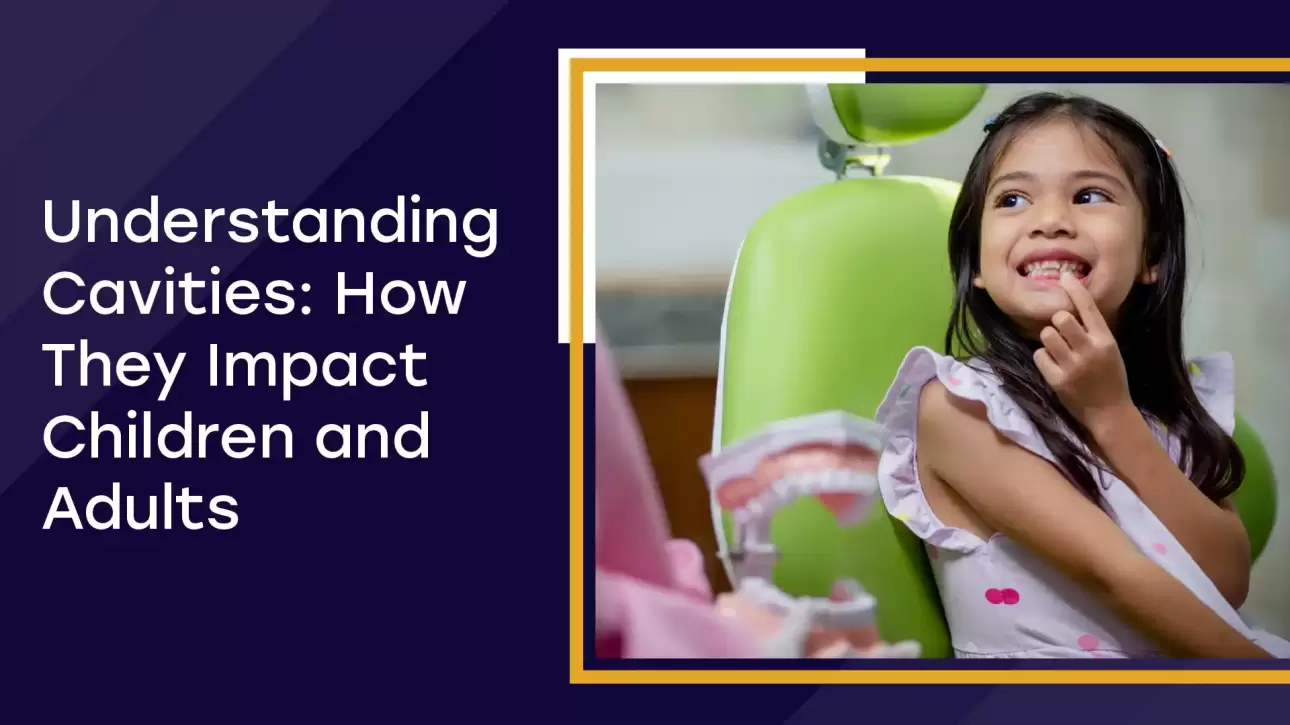 Understanding Cavities How They Impact Children And Adults