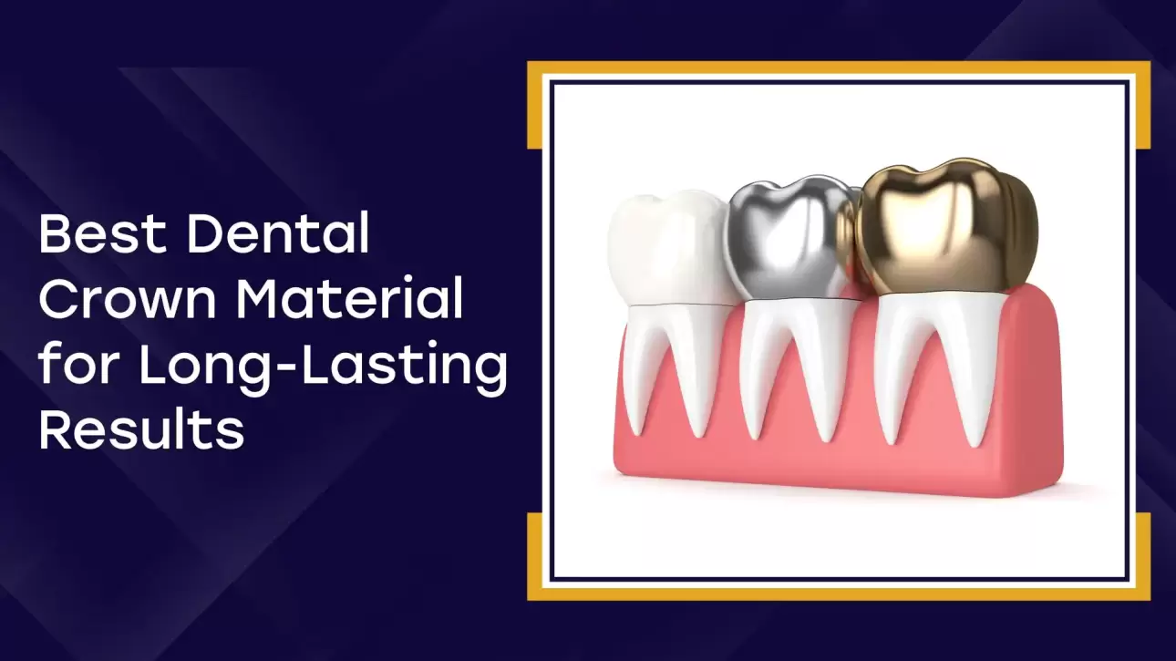 Best Dental Crown Material