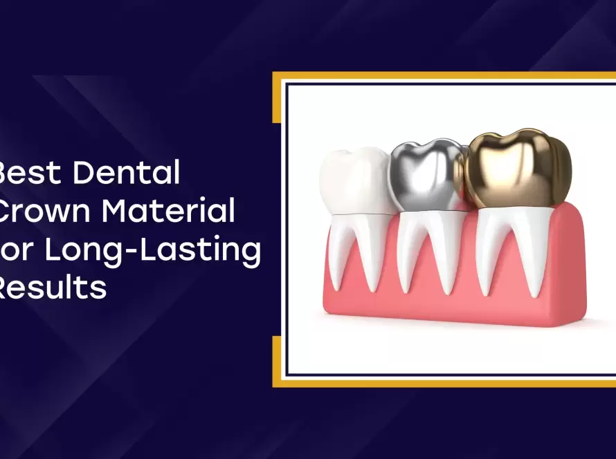 Best Dental Crown Material