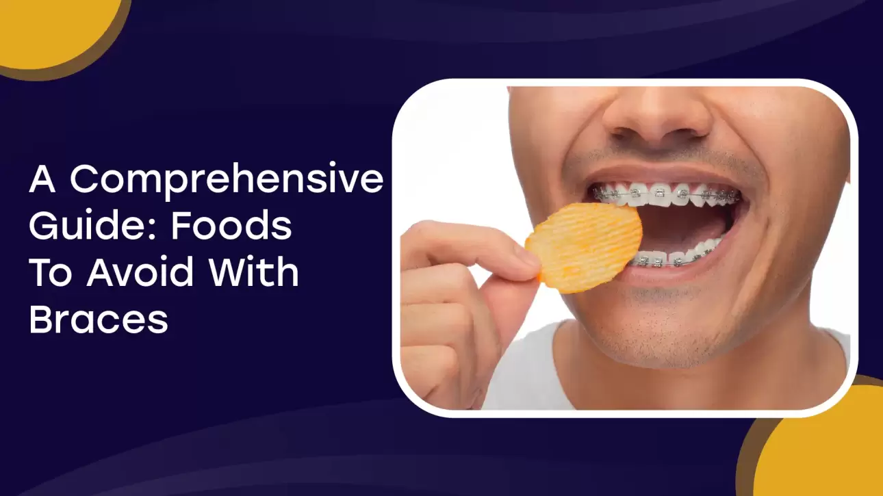 A Comprehensive Guide: Foods To Avoid With Braces