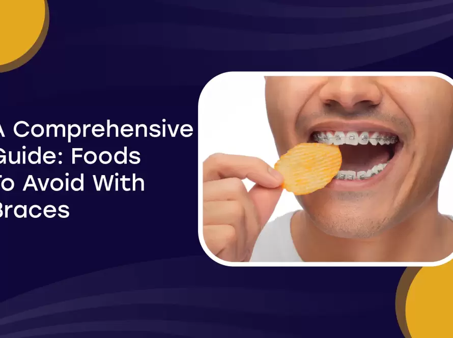 A Comprehensive Guide: Foods To Avoid With Braces