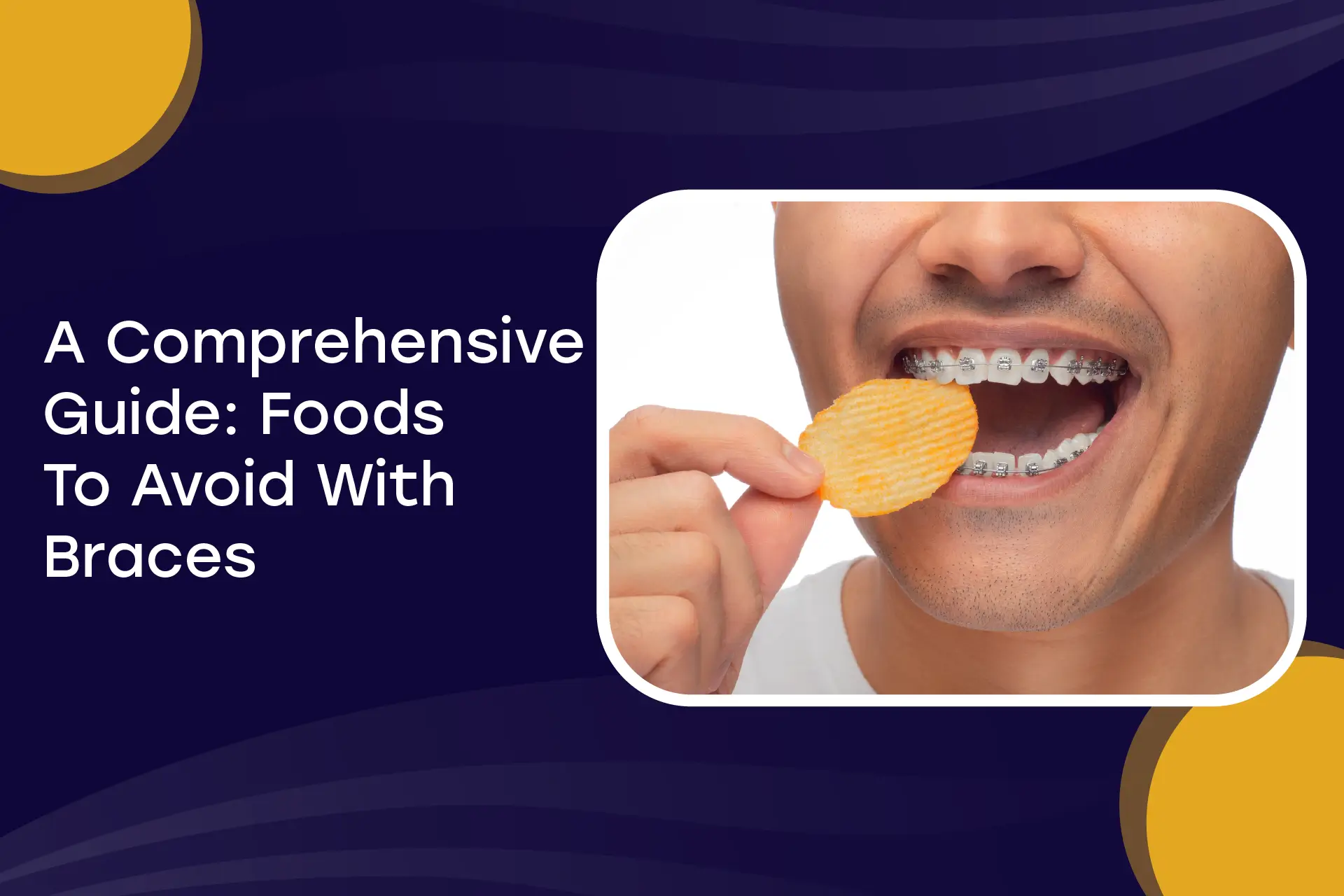 A Comprehensive Guide: Foods To Avoid With Braces