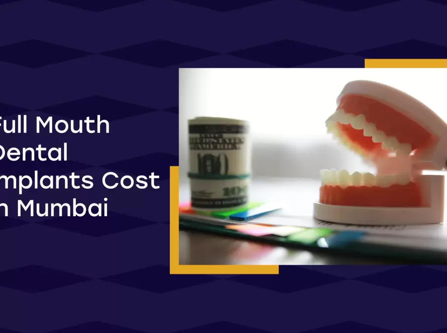 Full Mouth Dental Implants Cost In Mumbai