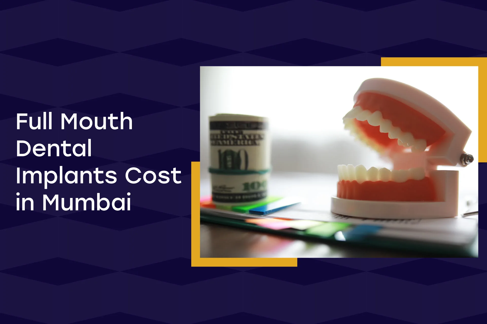 Full Mouth Dental Implants Cost In Mumbai