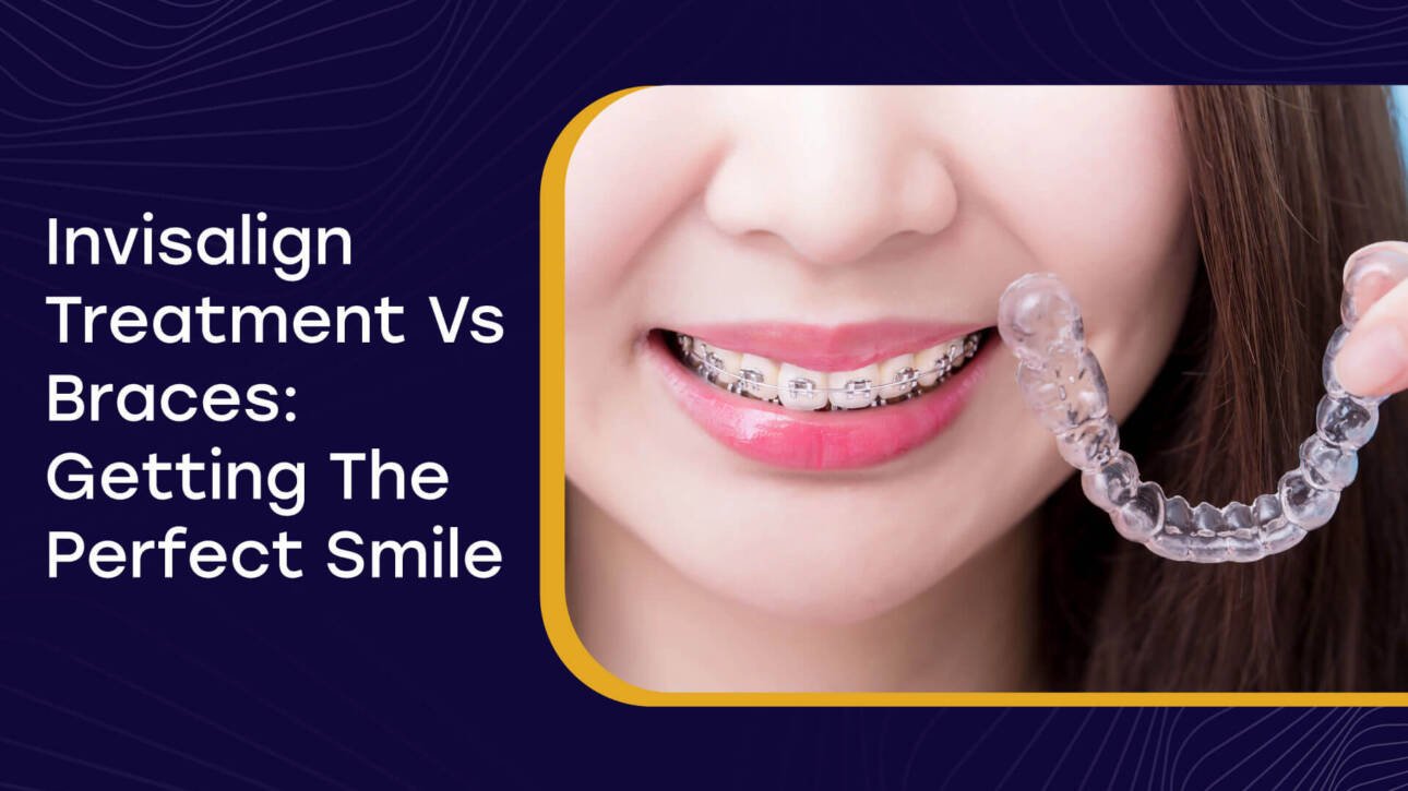 Invisalign Treatment Vs Braces