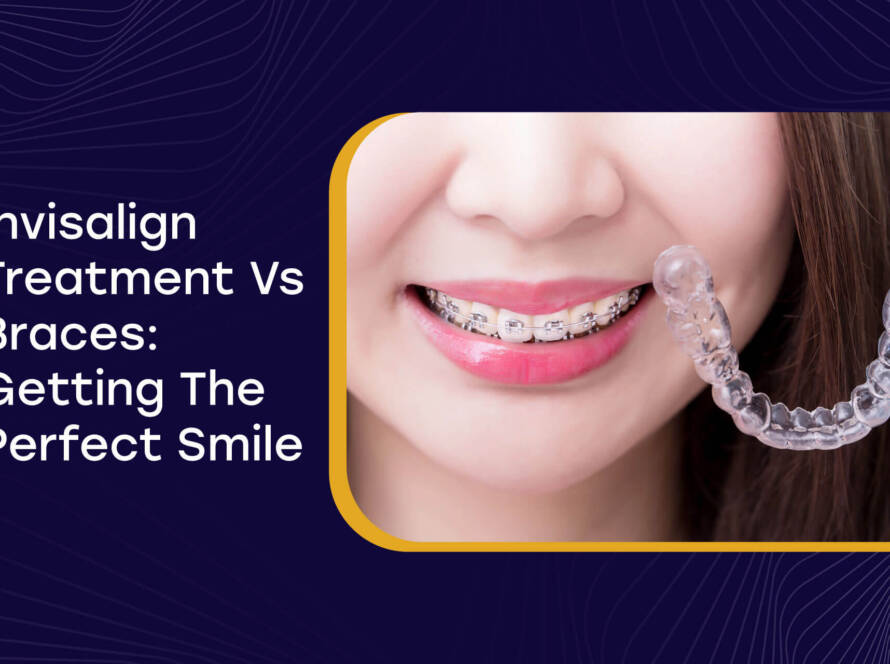 Invisalign Treatment Vs Braces