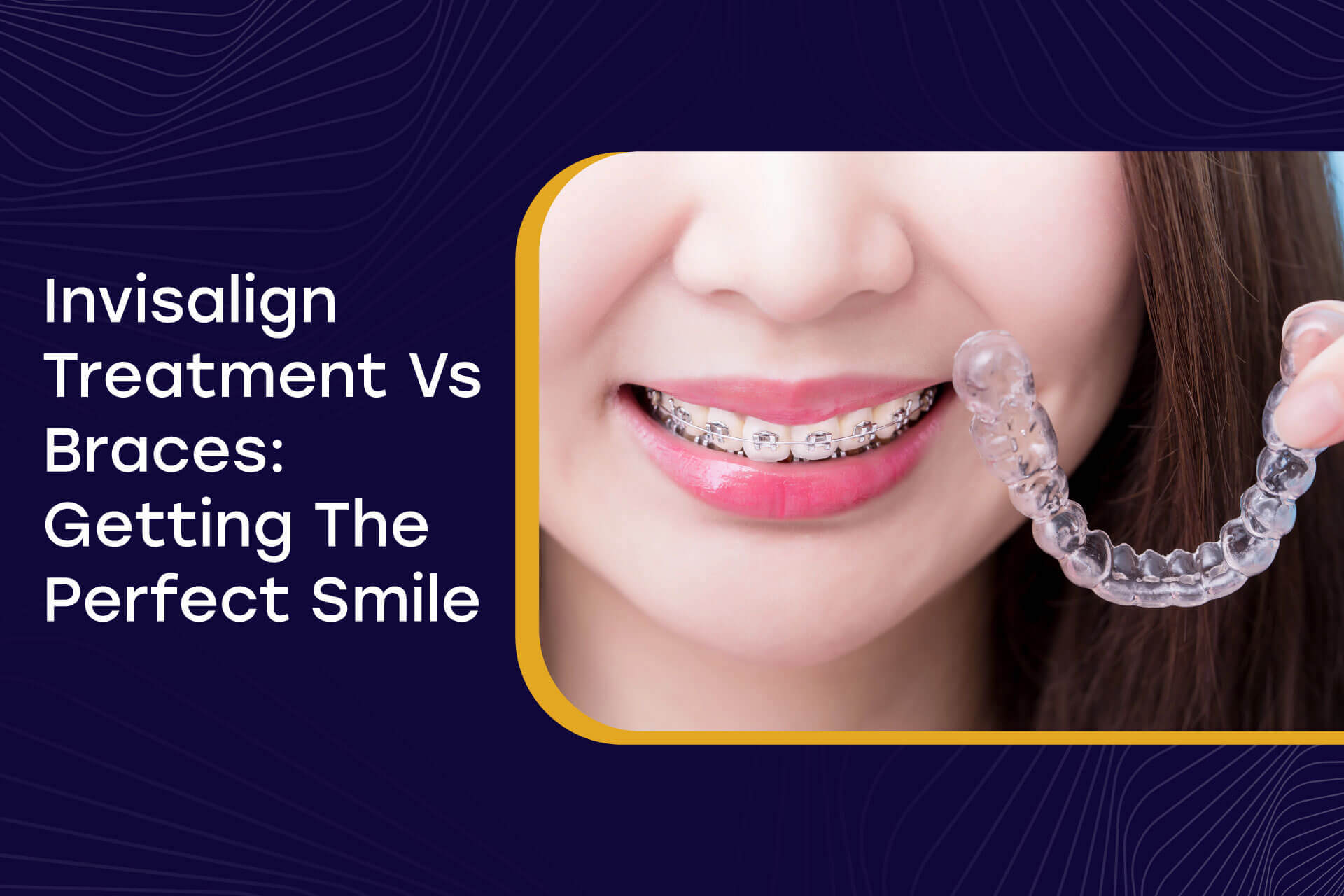 Invisalign Treatment Vs Braces