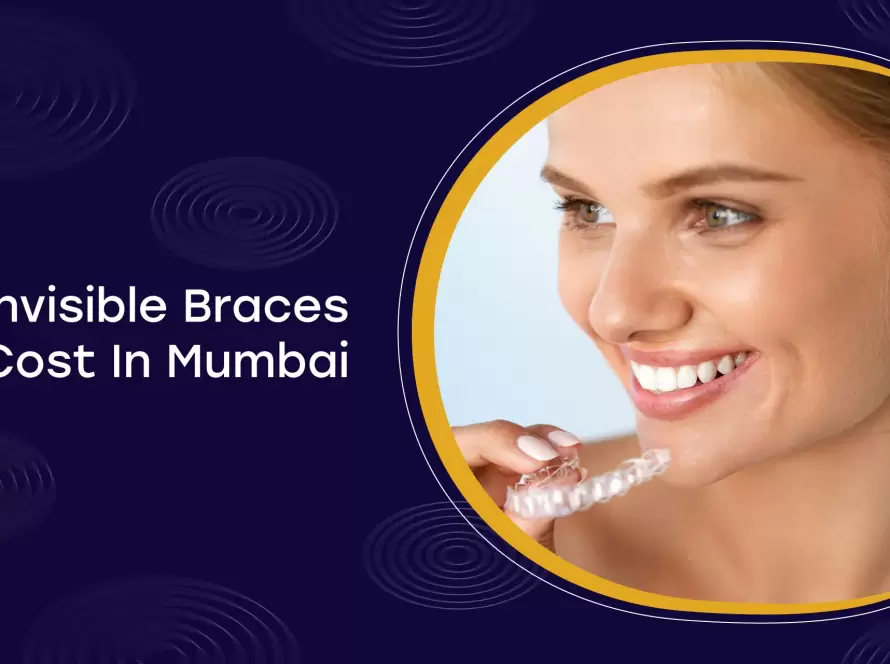 Invisible Braces Cost In Mumbai