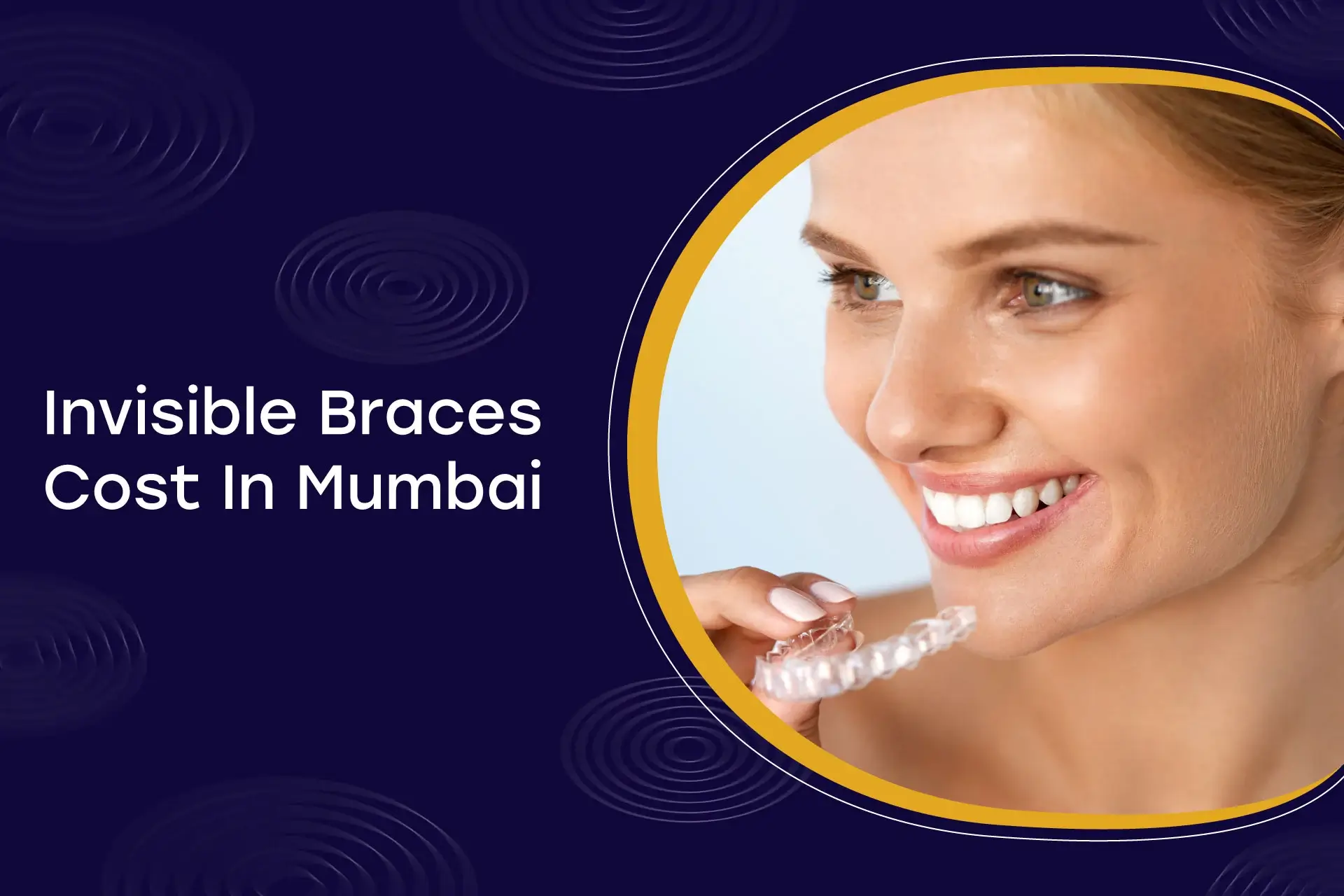 Invisible Braces Cost In Mumbai