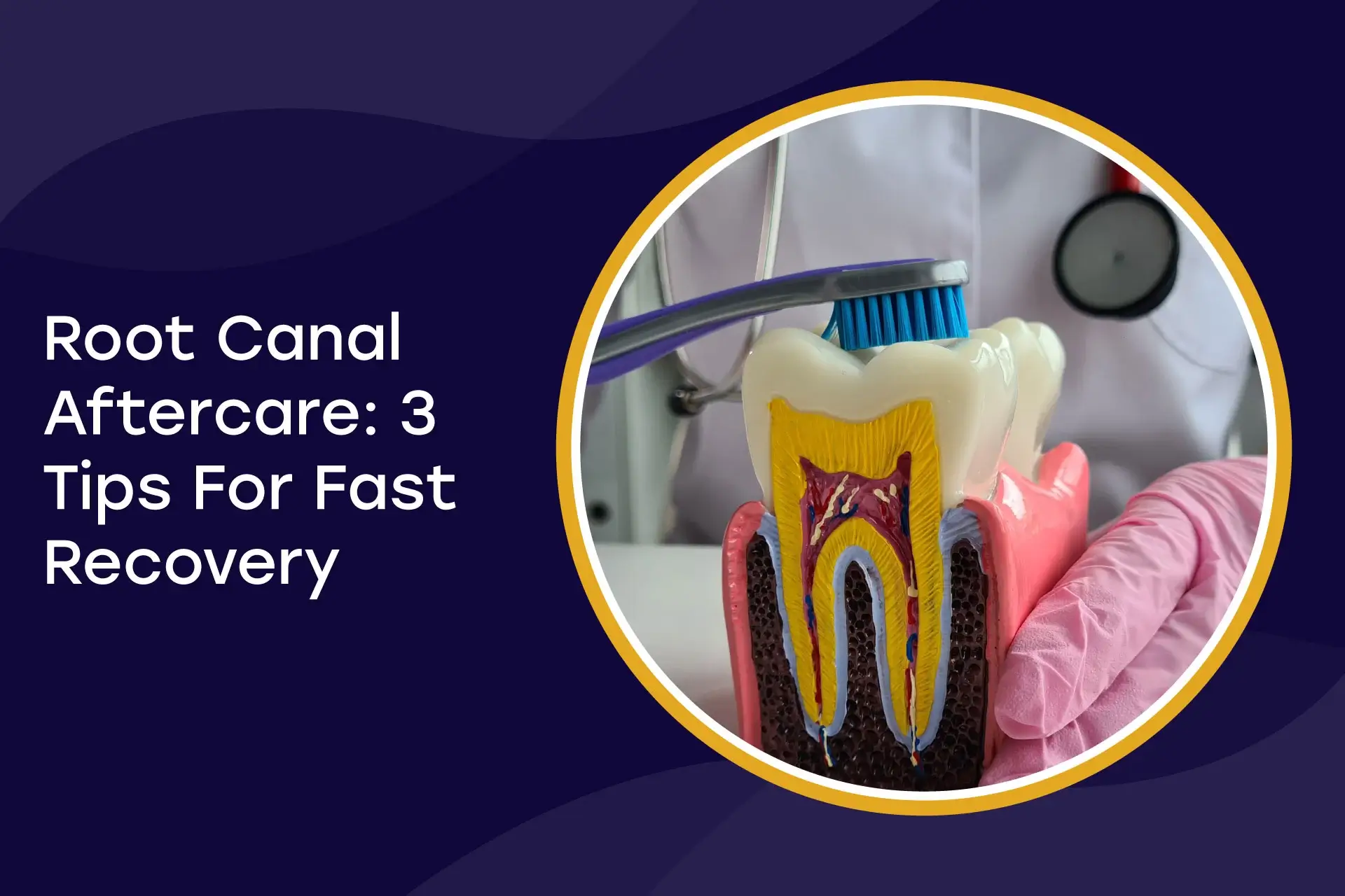 Root Canal Aftercare Tips