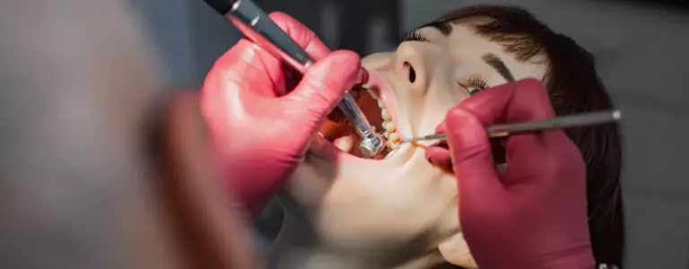 Service Dental Composite Filling