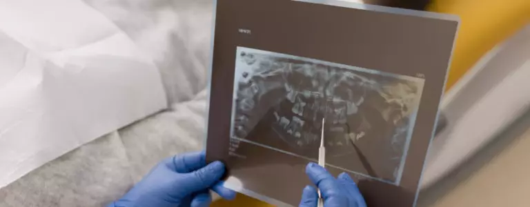 Service Dental Digital Xray