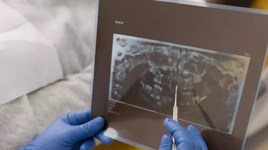 Service Dental Digital Xray