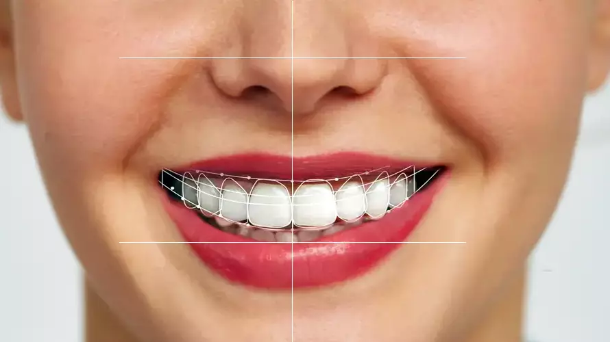 Service Digital Smile Design