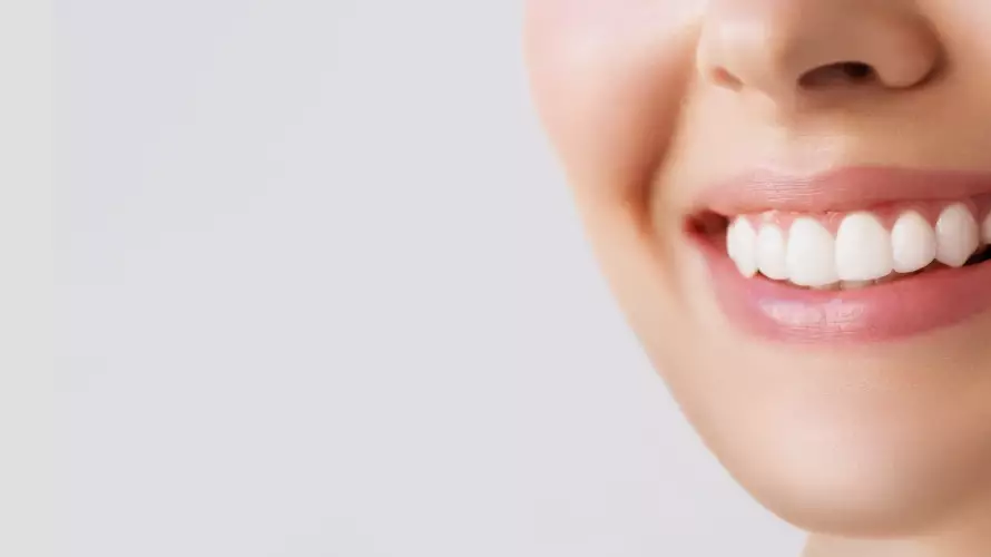 Service Teeth Whitening Bleaching