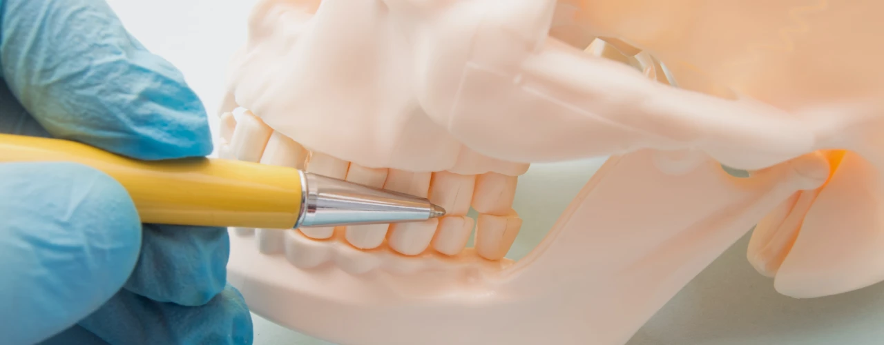 TMJ Treatment